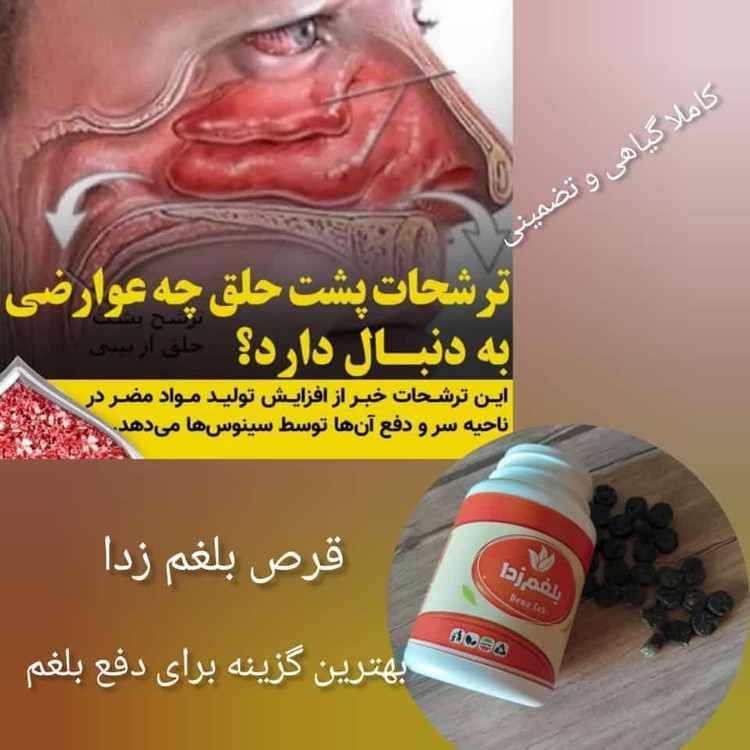 قرص ضد بغلم اصل و اورجینال رفع ورم معده و رفع ضعف حافظه و رفع بوی بد دهان ورفع سفیدی مو