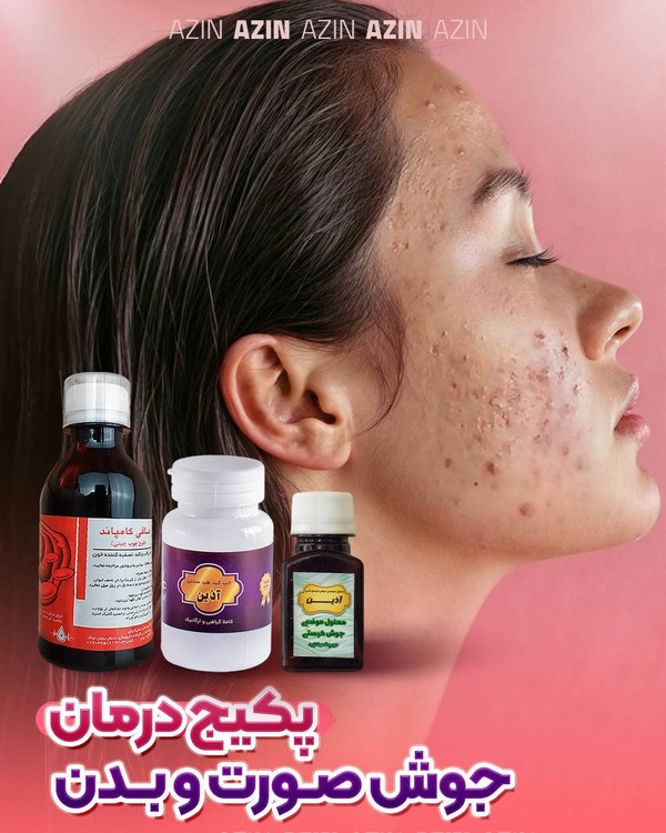 قیمت و خرید پکیج درمان جوش صورت و بدن کاملا گیاهی دارای هولوگرام