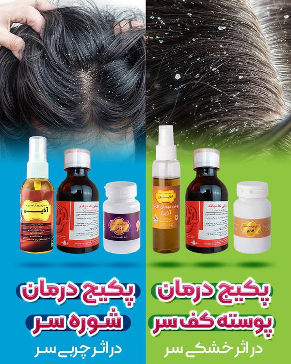 قیمت و خرید پکیج درمان پوسته کف سر و درمان شوره کف سر دارای هولوگرام و ایزو 9001